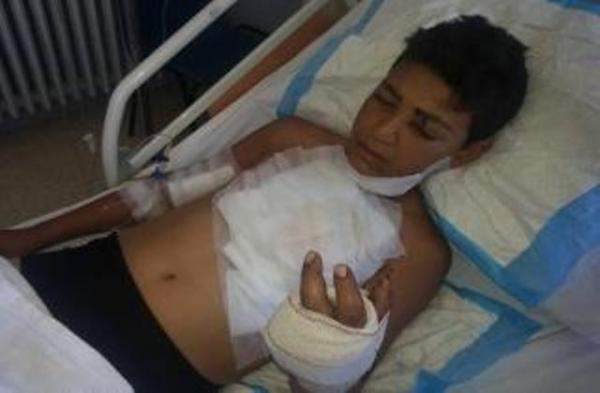 اصابة فتى في بعلبك بجروح بالغة بعدما انفجرت مفرقعة نارية بيده