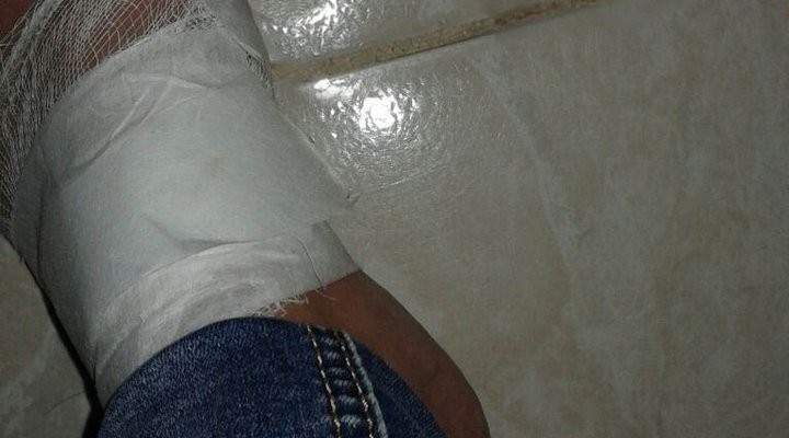 النشرة: نقل سورية لمستشفى تمنين تيجة تعرضها لتعذيب شديد على يد زوجها