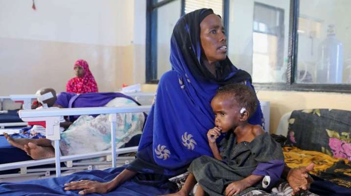 سوء التغذية يهدد حياة أكثر من نصف مليون طفل في مناطق وسط الصومال