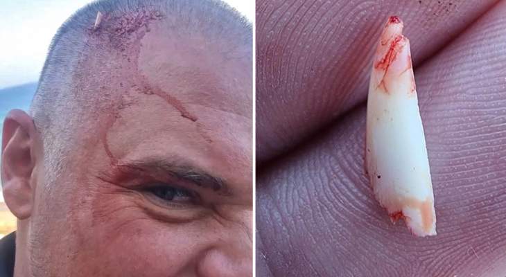 ذا صن: سمكة قرش هاجمت غواصاً في جنوب أفريقيا وتركت إحدى أسنانها برأسه