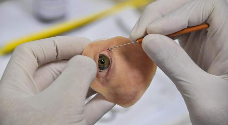 معهد فرنسي توصل لنتائج مشجعة لعلاج جديد ضد أكثر أشكال سرطان العين شيوعا