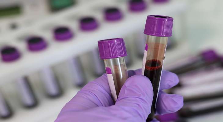 تحليل الدم Pathfinder يكشف معظم أنواع السرطان