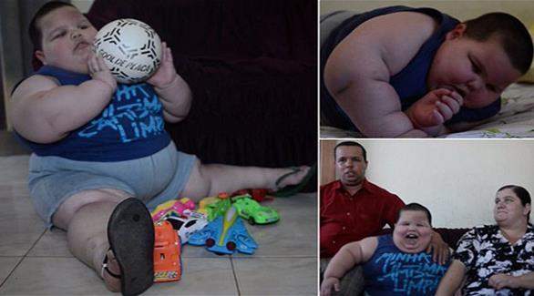 طفل برازيلي في الثالثة من العمر يزن 70 كيلوغراما