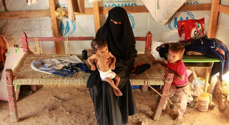 منظمات الأمم المتحدة: سوء التغذية الحاد يهدد نصف الأطفال دون الخامسة باليمن في 2021