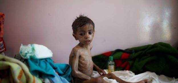 الغارديان: نحو 7 مليون شخص في اليمن على حافة المجاعة 