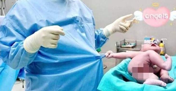 طفل يمسك بوزرة طبيب بعد لحظات من ولادته