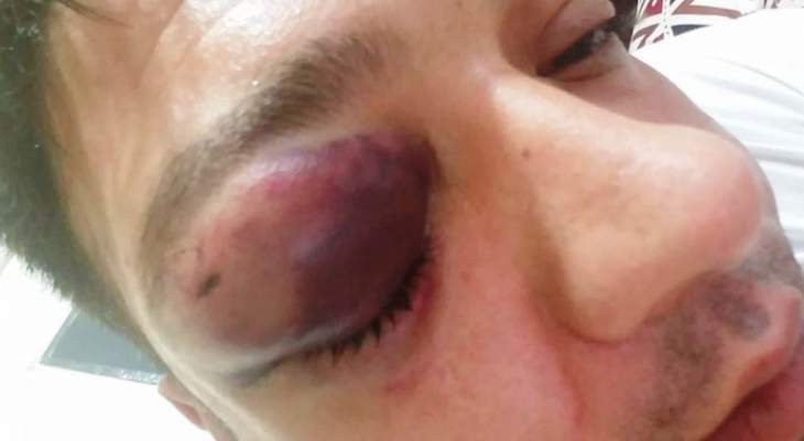 النشرة: إعتداء على مواطن في الطريق الجديدة بسبب موقفه من قضية خاشقجي