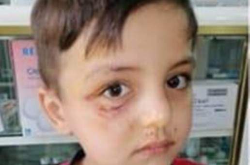 النشرة: واوي هاجم طفلين في بلدة ديركيفا الجنوبية